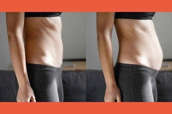 LA-EMS Body Sculpting results Burley