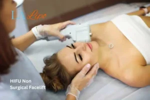Woman having Hi-Fu to reduce wrinkles Burley.