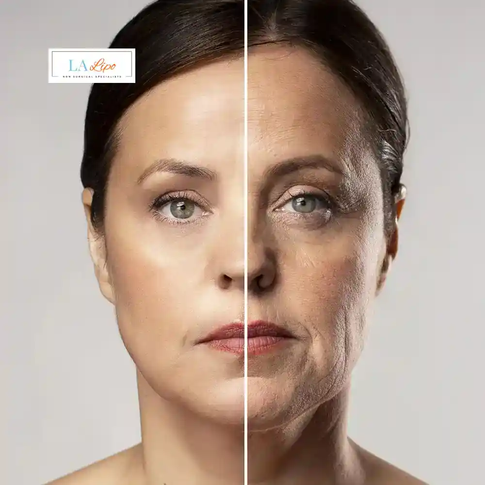 How Can You Tell If Non-Surgical Skin Tightening Is Right for You Burley?