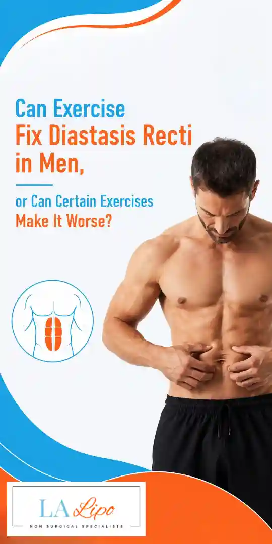 Can Exercise Fix Diastasis Recti in Men, or Can Certain Exercises Make It Worse Burley?